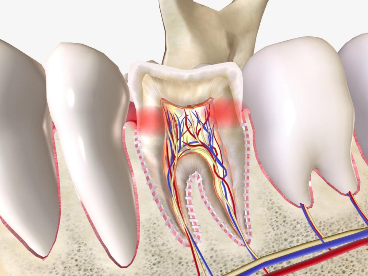 dental