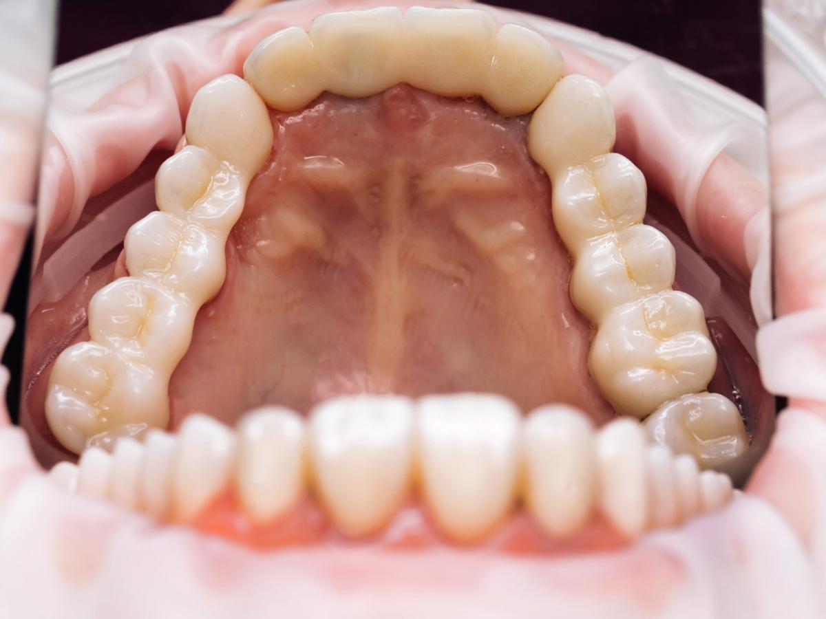 dental