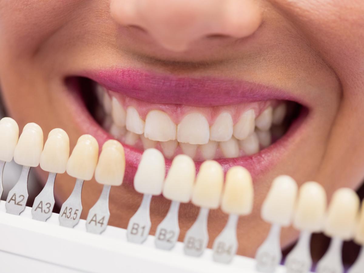 teeth
